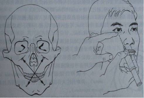 牙科必懂的口腔區域性麻醉