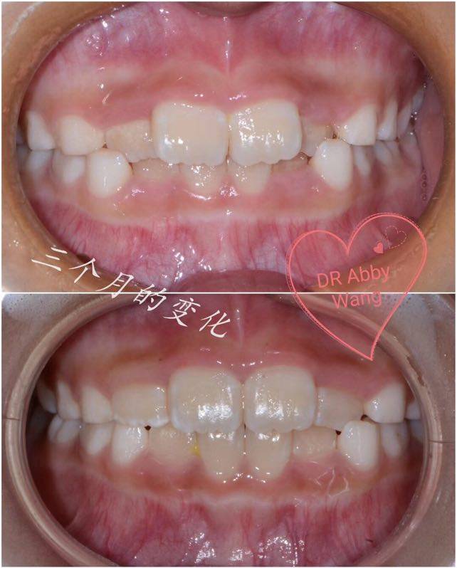 兒童牙科服務哪家靠譜？星光口腔門診