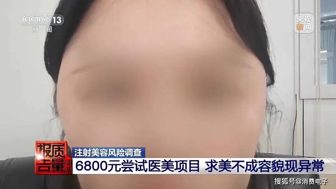 央視曝光醫美注射亂象，無證“醫生”違規注射化妝品，消費者“美容”變“毀容”！